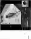 Fig. 32 - METHODS AND APPARATUSES FOR TELE-MEDICINE