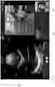 Fig. 35 - METHODS AND APPARATUSES FOR TELE-MEDICINE