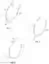 Fig. 02 - Method for intra-abdominally moving an organ