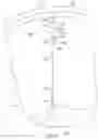Fig. 49 - Method for intra-abdominally moving an organ