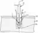 Fig. 01 - Hybrid Suture Anchor