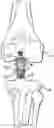 Fig. 01 - METHODS AND PROCEDURES FOR LIGAMENT REPAIR