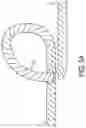 Fig. 04 - Locking suture construct