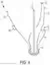 Fig. 11 - Locking suture construct