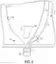 Fig. 12 - Locking suture construct