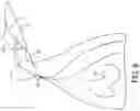 Fig. 16 - Locking suture construct
