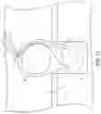 Fig. 19 - Locking suture construct
