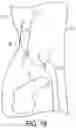 Fig. 25 - Locking suture construct