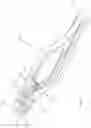 Fig. 07 - Surgical cutting device