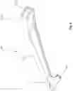 Fig. 08 - Surgical cutting device