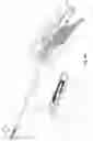 Fig. 19 - Surgical cutting device