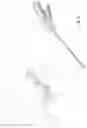 Fig. 22 - Surgical cutting device