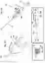 Fig. 53 - Surgical cutting device