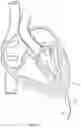 Fig. 02 - Suturing devices and methods for suturing an opening in the apex of the heart