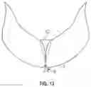Fig. 13 - Suturing devices and methods for suturing an opening in the apex of the heart