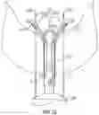 Fig. 20 - Suturing devices and methods for suturing an opening in the apex of the heart