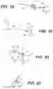 Fig. 08 - System And Method For All-Inside Suture Fixation For Implant Attachment And Soft Tissue Repair