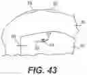 Fig. 17 - System And Method For All-Inside Suture Fixation For Implant Attachment And Soft Tissue Repair