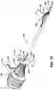 Fig. 10 - Knotless suture anchor with unthreaded nose