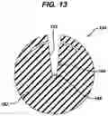 Fig. 12 - Knotless suture anchor with unthreaded nose