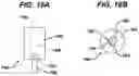 Fig. 15 - Knotless suture anchor with unthreaded nose