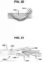 Fig. 20 - Knotless suture anchor with unthreaded nose