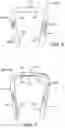 Fig. 06 - Surgical bending instrument