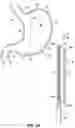 Fig. 03 - END EFFECTORS, SURGICAL STAPLING DEVICES, AND METHODS OF USING SAME