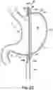 Fig. 05 - END EFFECTORS, SURGICAL STAPLING DEVICES, AND METHODS OF USING SAME