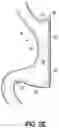 Fig. 07 - END EFFECTORS, SURGICAL STAPLING DEVICES, AND METHODS OF USING SAME
