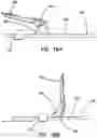 Fig. 15 - Surgical stapler having a powered handle