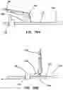 Fig. 17 - Surgical stapler having a powered handle