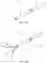 Fig. 17 - Clipping device for large defects, perforations and fistulas