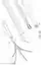 Fig. 20 - Clipping device for large defects, perforations and fistulas