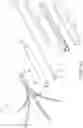 Fig. 27 - Clipping device for large defects, perforations and fistulas