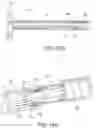 Fig. 33 - Clipping device for large defects, perforations and fistulas