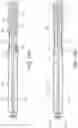 Fig. 35 - Clipping device for large defects, perforations and fistulas