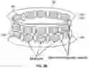 Fig. 04 - Cardiac shunt device and delivery system