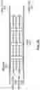 Fig. 05 - Cardiac shunt device and delivery system