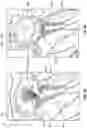 Fig. 13 - Cardiac shunt device and delivery system