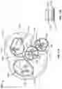 Fig. 15 - Cardiac shunt device and delivery system
