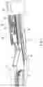 Fig. 04 - Surgical clip applier