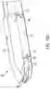 Fig. 14 - Surgical clip applier