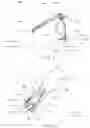 Fig. 02 - Hemostatic clip with needle passer