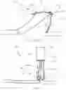 Fig. 03 - Hemostatic clip with needle passer