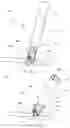 Fig. 04 - Hemostatic clip with needle passer