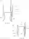 Fig. 05 - Hemostatic clip with needle passer