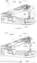 Fig. 16 - Hemostatic clip with needle passer