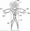 Fig. 01 - Aneurysm devices with additional anchoring mechanisms and associated systems and methods