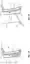 Fig. 13 - Devices and methods using percutaneous transjugular carotid flow reversal